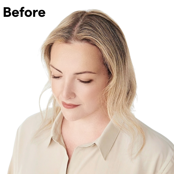 Best human hair topper for thin hair